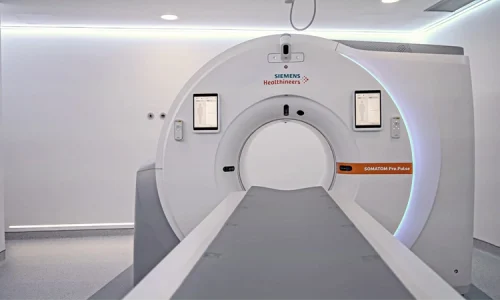 El HUBU estrena un TAC de doble fuente pionero en el mundo
